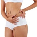 Liposuction Surgery in Goa from Dr. Sonalini