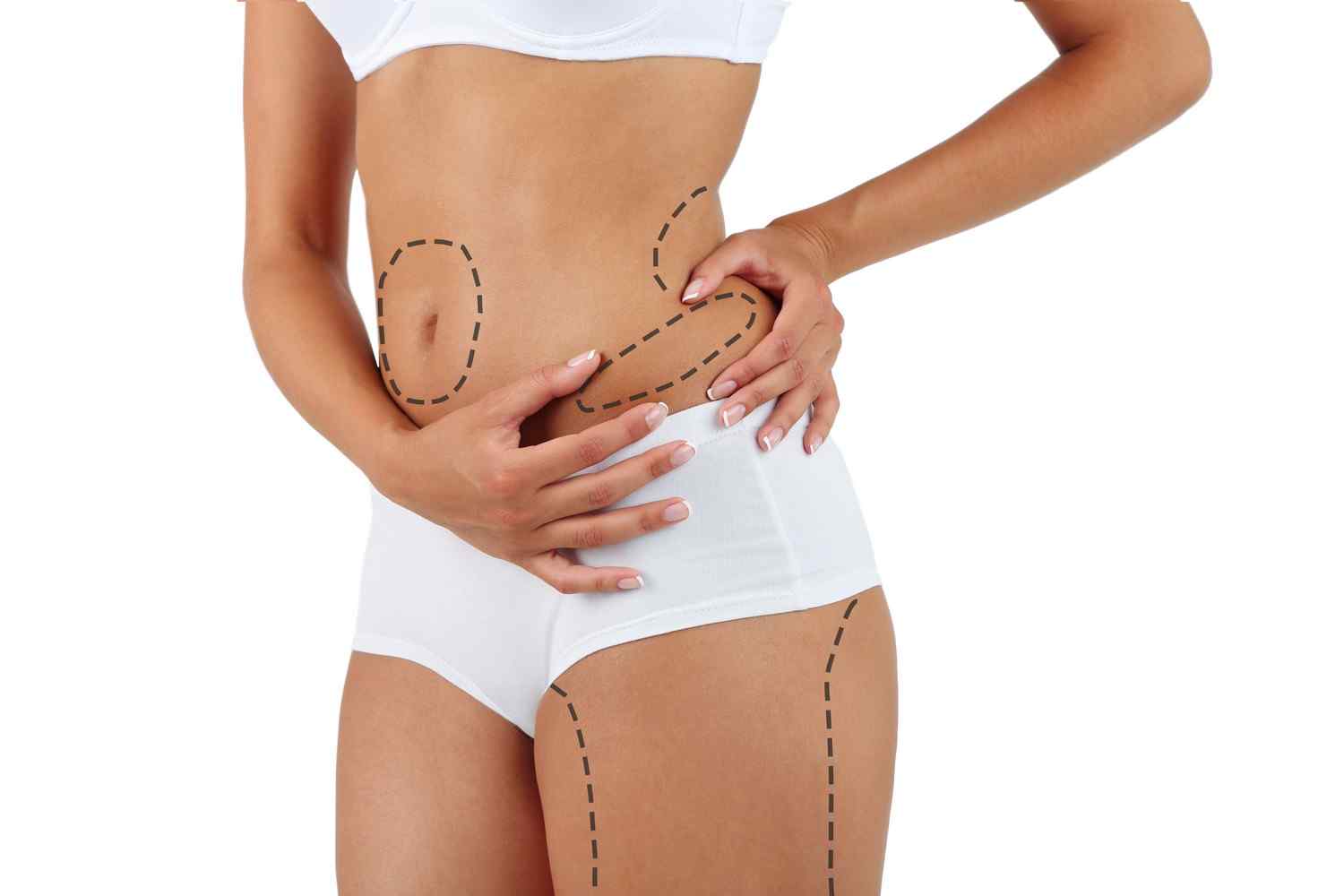 Liposuction Surgery in Goa from Dr. Sonalini