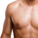 gynaecomastia surgery in Goa