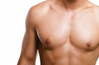 gynaecomastia surgery in Goa