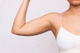Weight Loss Lifts - Dr.Sonalini Aesthetics
