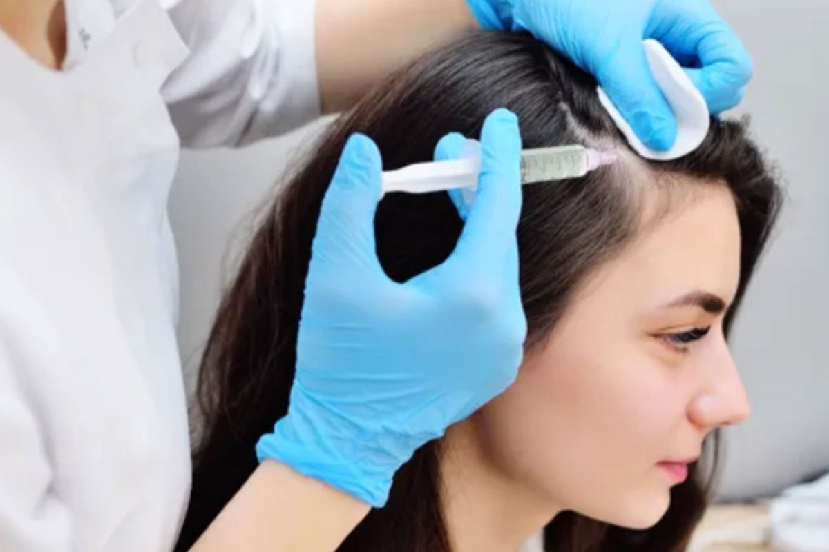 hairloss-1200x800.jpg