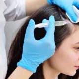 PRP Hair Treatment in Goa