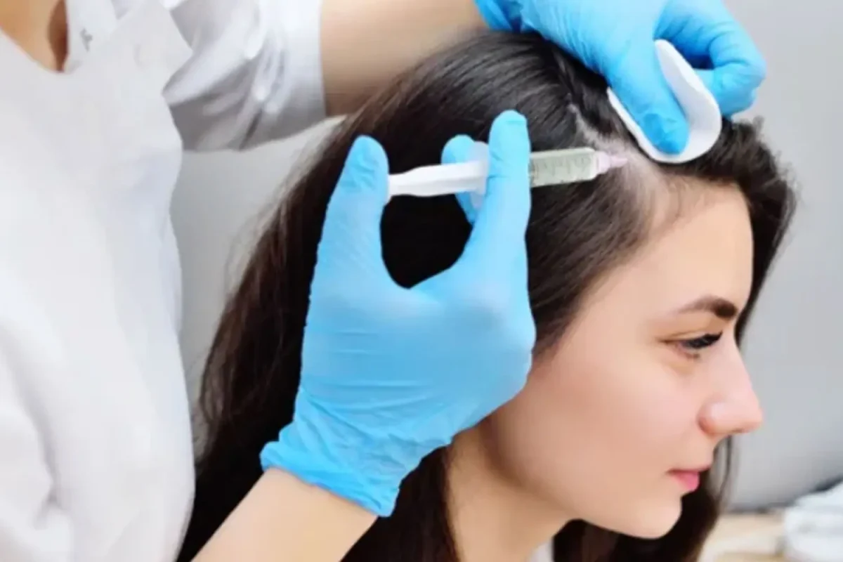 hairloss-1200x800.webp